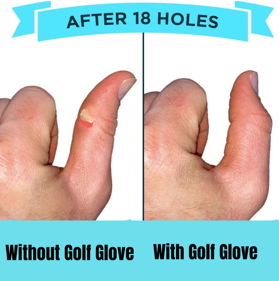 do golf gloves prevent blisters