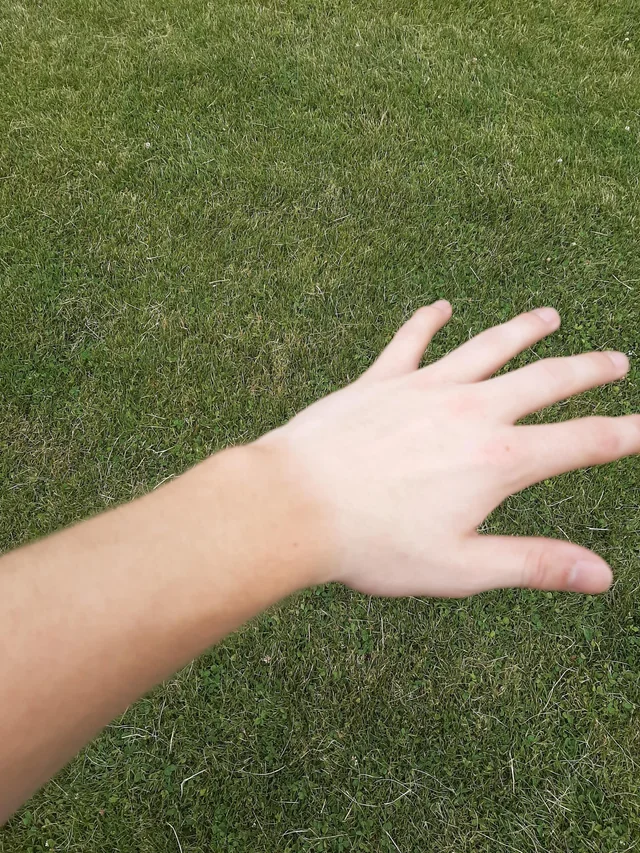 tan due to playing golf without gloves